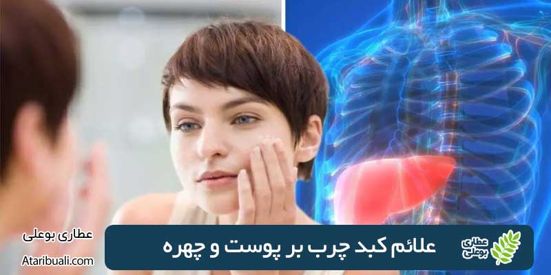 علائم کبد چرب بر پوست و چهره