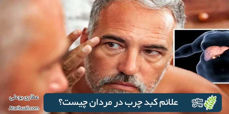 علائم کبد چرب در مردان