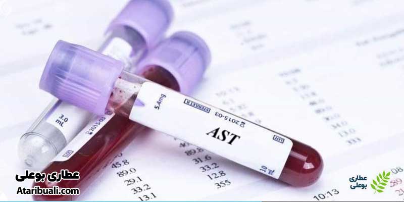 آزمایش آسپارتات آمینوترانسفراز یا Aspartate Aminotransferase به اختصار (AST)