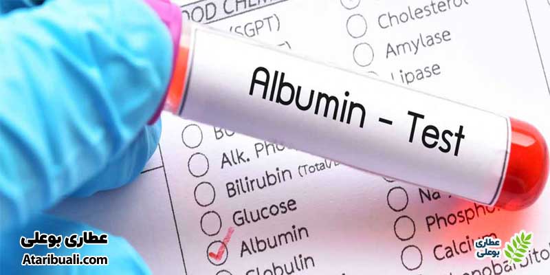 آزمایش آلبومین یا Albumin Test