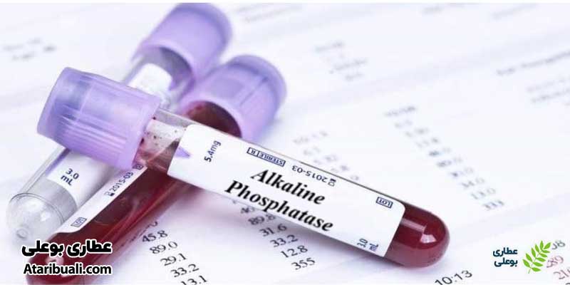 آزمایش فسفاتاز آلکالین یا Alkaline Phosphatase به اختصار (ALP)