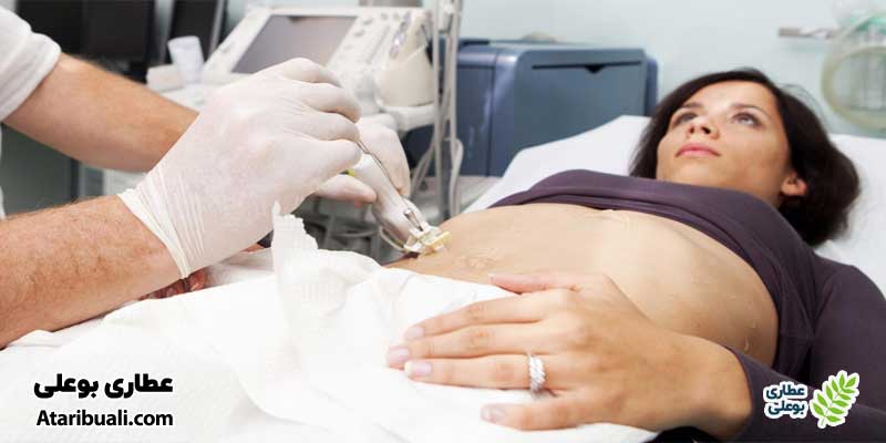 آزمایش لیور بیوپسی