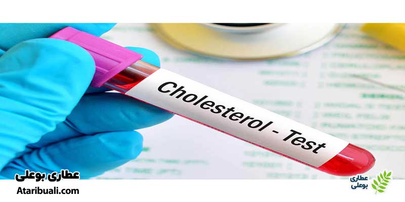 آزمایش کلسترول یا Cholesterol Test