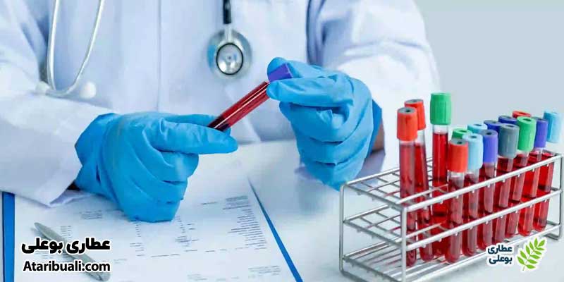 آزمایش کلسترول یا Cholesterol Test