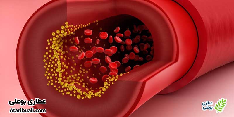 افرادی با سطح بالای‌تری گلیسیرید در خون