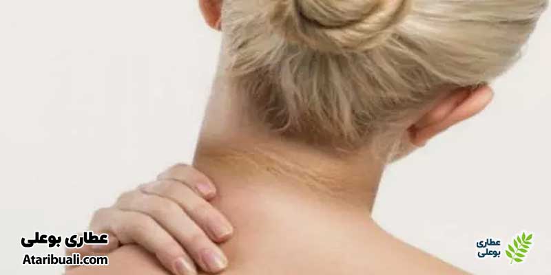 تیره شدن پوست در چین‌های گردن
