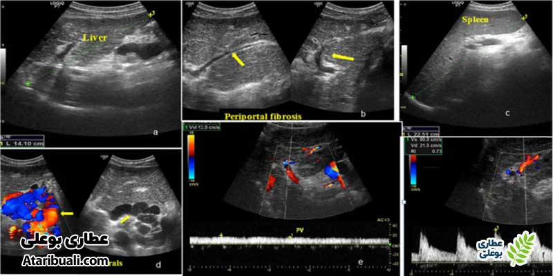 دوپلر اولتراسونوگرافی (Doppler Ultrasonography)