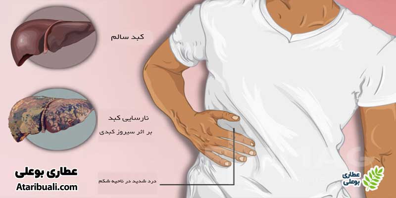 عوارض خطرناک کبد چرب