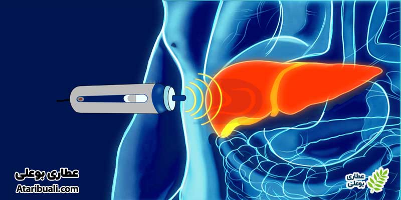 فیبرو اسکن (FibroScan)
