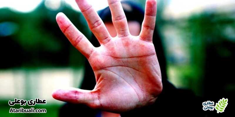 قرمزی کف دست