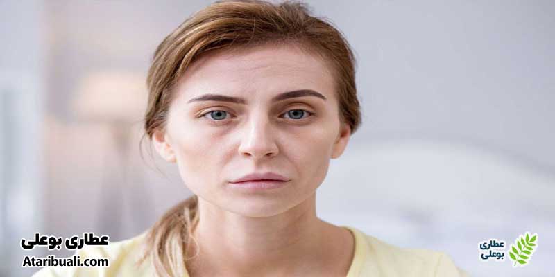 پوست رنگ ‌پریده
