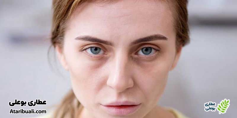 پوست رنگ‌پریده
