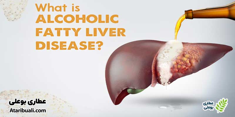 کبد چرب الکلی(Alcoholic Fatty Liver Disease)