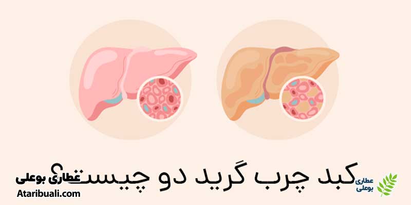 کبد چرب گرید دو (استئو هپاتیت)
