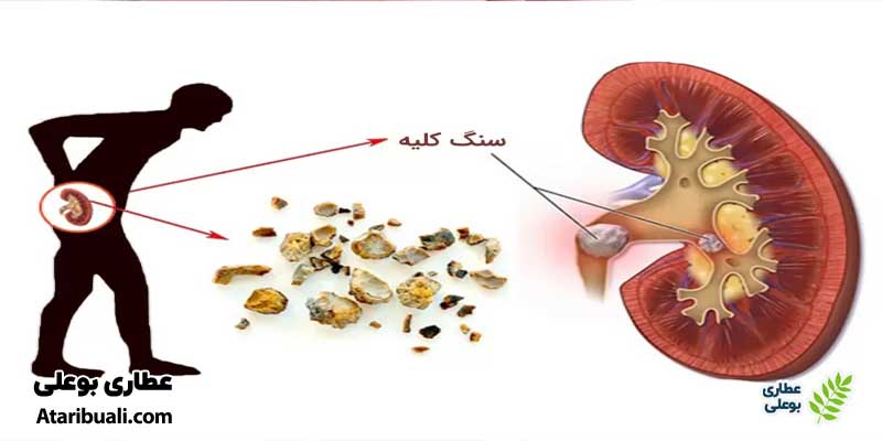 موارد منع مصرف عرق هل