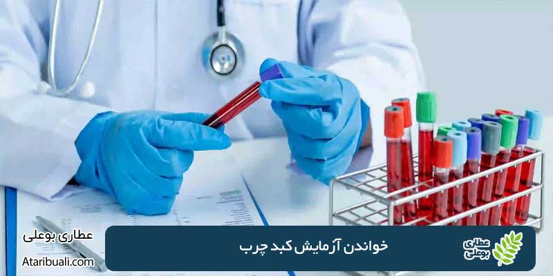 خواندن آزمایش کبد چرب