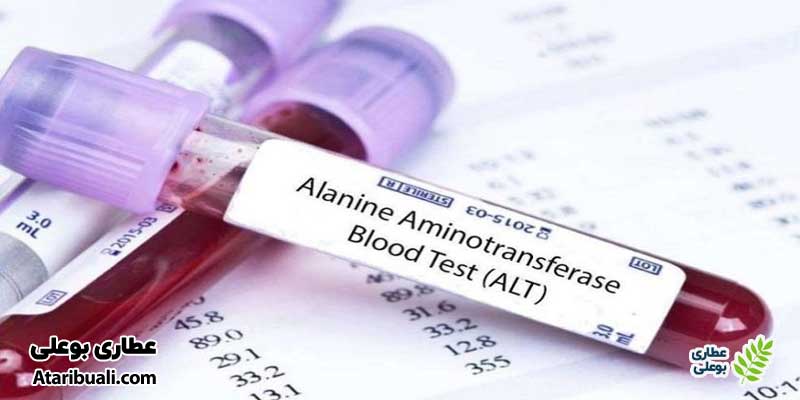 آزمایش آلانین آمینوترانسفراز (ALT)