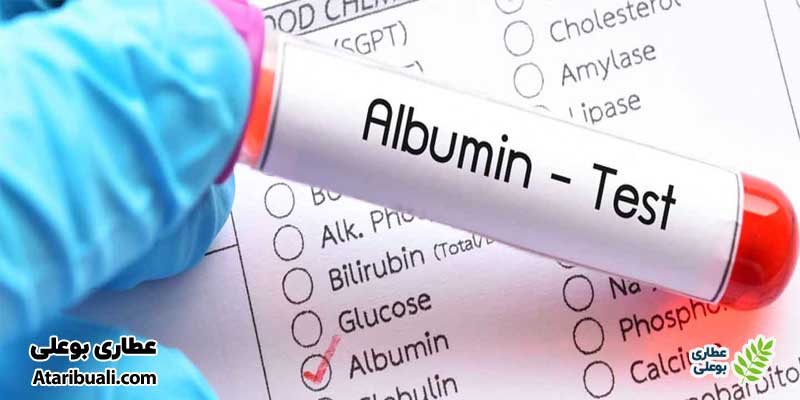  آزمایش آلبومین (Albumin)