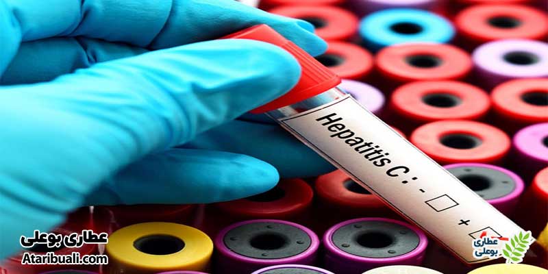 آزمایش آنتی‌بادی ویروس هپاتیت سی   (HCV) 