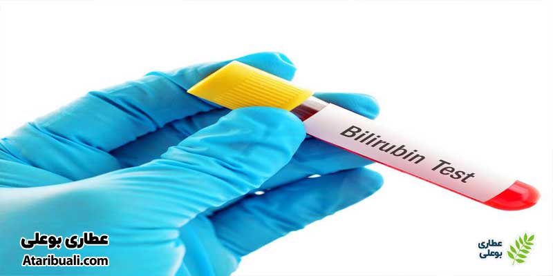 آزمایش بیلی‌روبین تام (Total bilirubin)