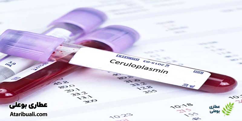 آزمایش سرولوپلاسمین (ceruloplasmin)