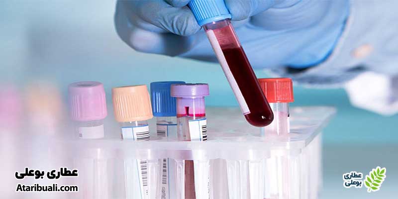 آزمایش لیوره سیومتری(Liver Biopsy)