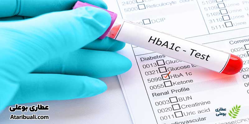  آزمایش هموگلوبین (Hemoglobin)