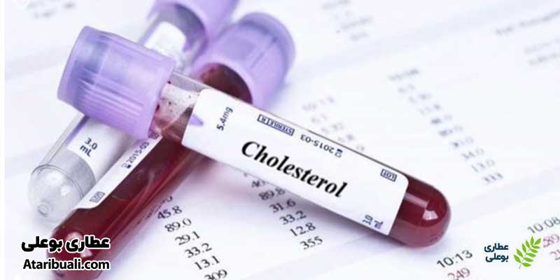 آزمایش کلسترول ((Cholesterol Test