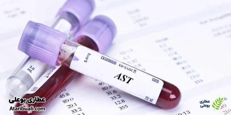  آسپارتات آمینوترانسفراز ( AST یا SGOT)