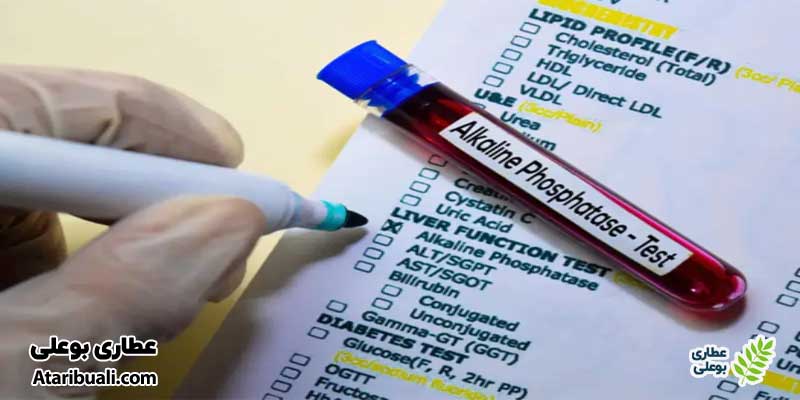 آزمایش آلکالین فسفاتاز (ALP)