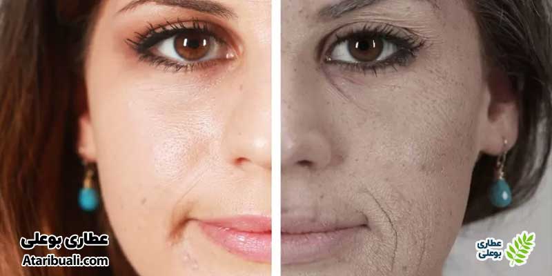تغییرات چهره بعد از ترک سیگار
