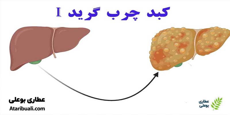 درمان کبد چرب گرید ۱ در بارداری