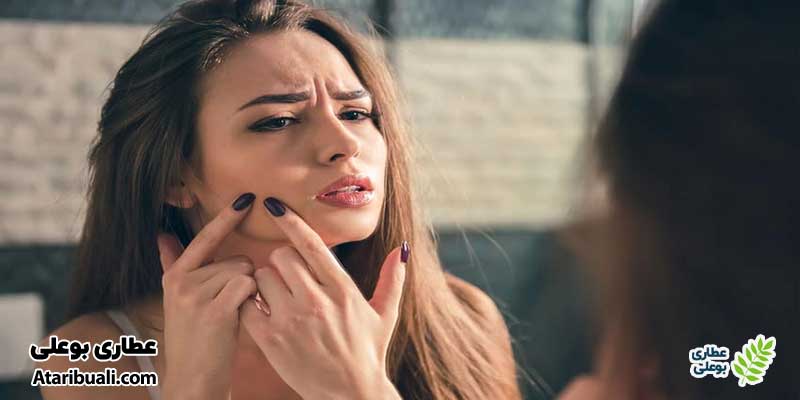 تفاوت جوش هورمونی و کبدی
