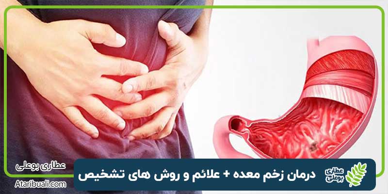روش های درمان زخم معده + علائم و روش تشخیص