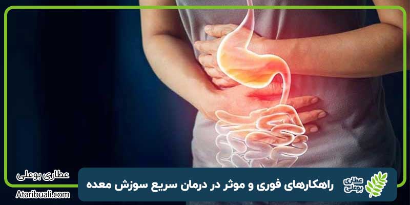 سوزش معده