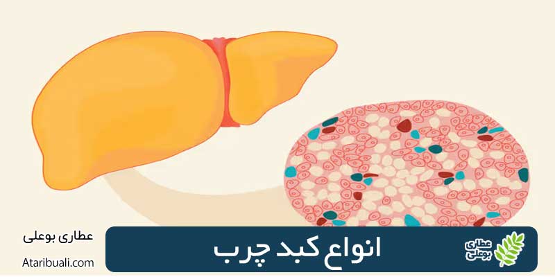 انواع کبد چرب