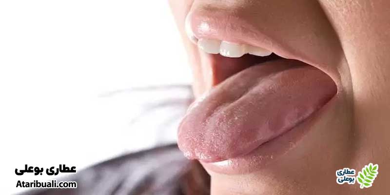 آیا تلخی دهان خطرناک است؟