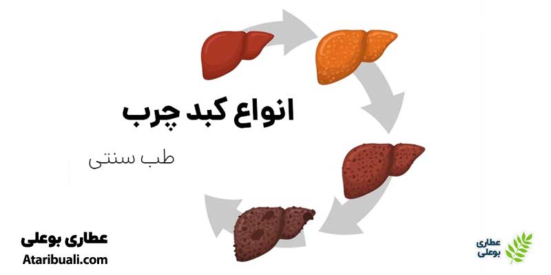 انواع کبد چرب در طب سنتی