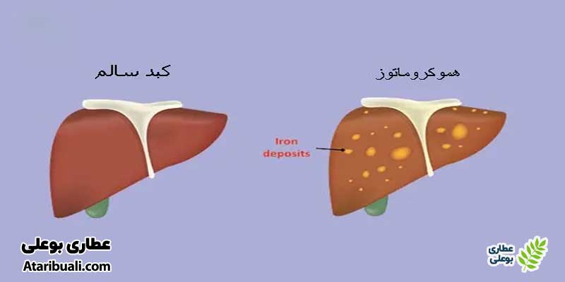 بیماری‌های متابولیک