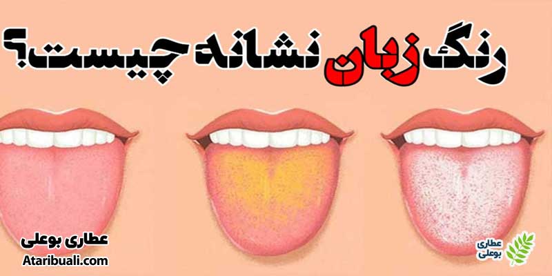 تشخیص کبد چرب از رنگ زبان‌