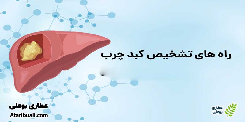 روش‌های تشخیص کبد چرب در منزل