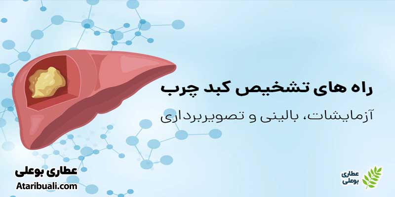 روش‌های تشخیص کبد چرب