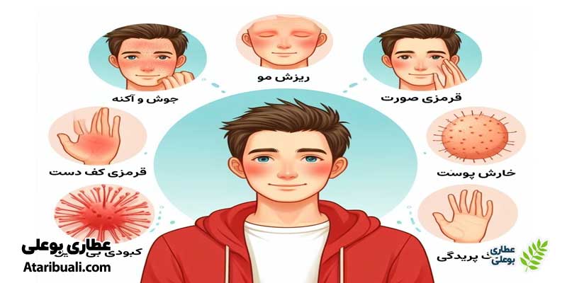 علائم کبد چرب در چهره