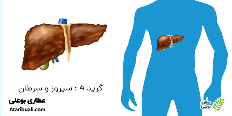 علت کبد چرب گرید 4