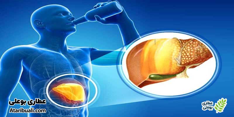 کبد چرب الکلی ساده (Alcoholic Fatty Liver)