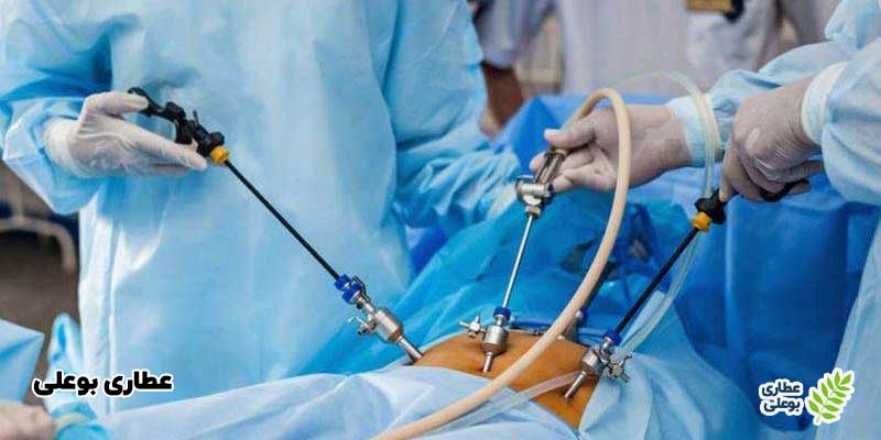 آندوسکوپی معده با بیهوشی یا بدون بیهوشی؟