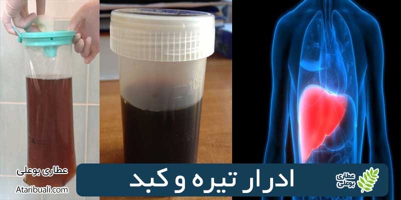 ادرار تیره و کبد