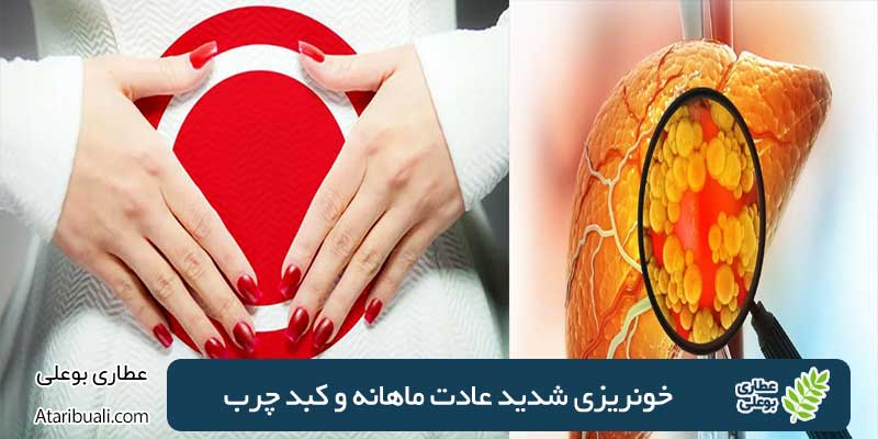 خونریزی شدید عادت ماهانه و کبد چرب