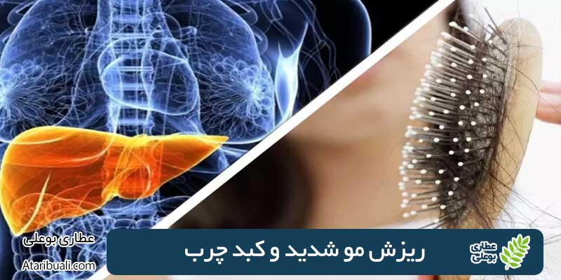 ریزش مو شدید و کبد چرب