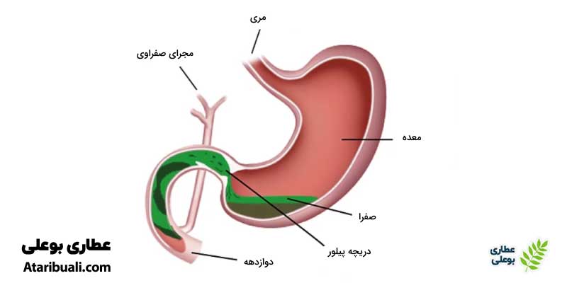 ترشح صفرا و تأثیر آن بر ریزش مو